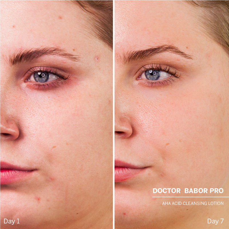 400727_Doctor BABOR PRO veido prausiklis su rūgštimi (losjonas). AHA Acid Cleansing Lotion_3